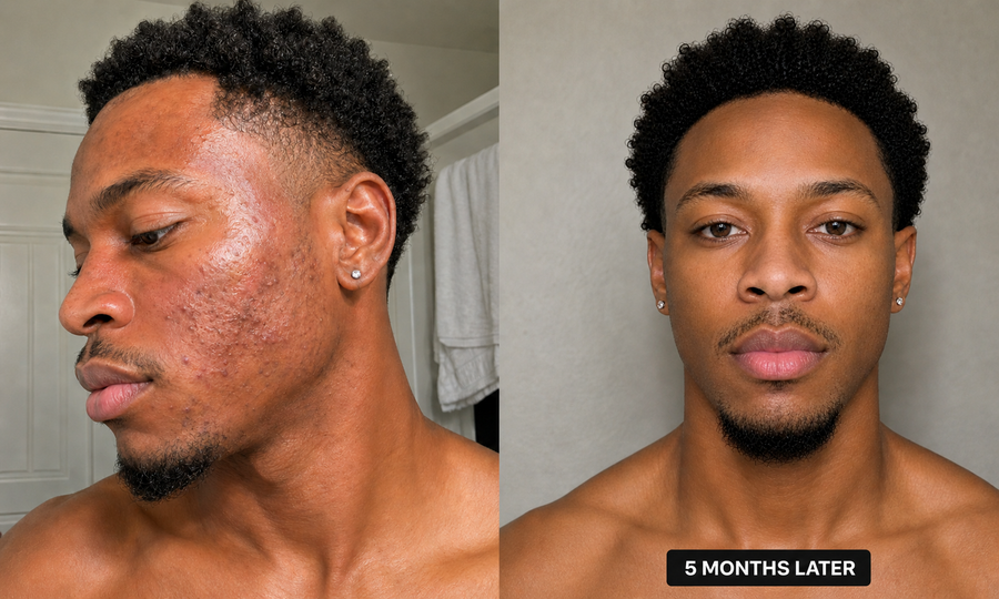 Before and After Results