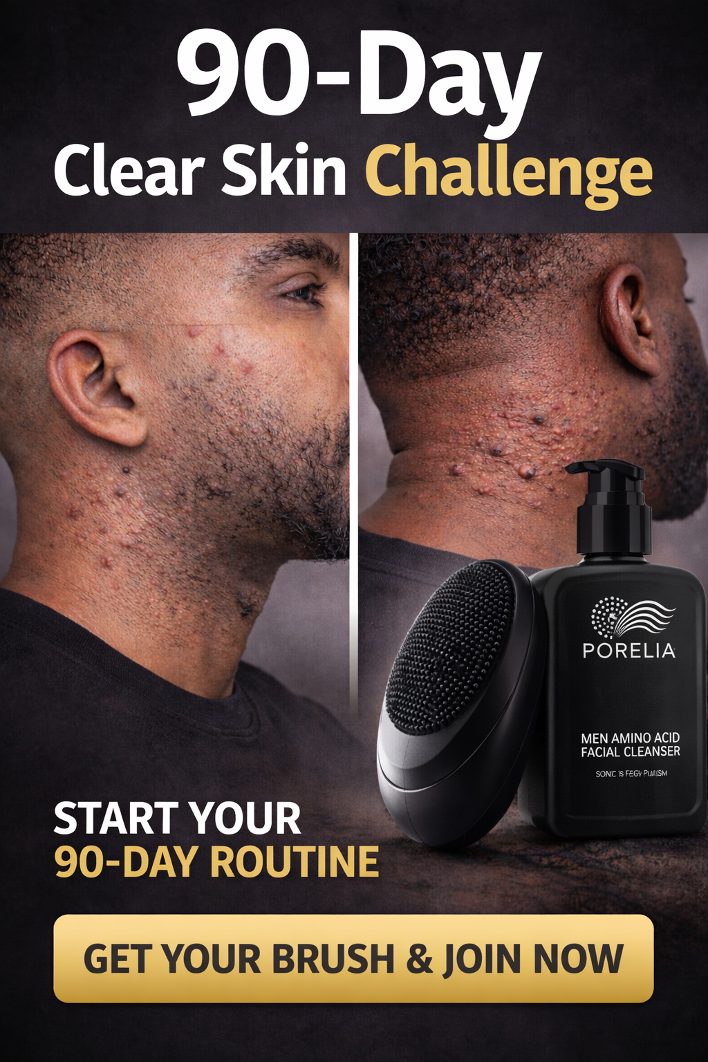 The 90-Day Clear Skin Challenge